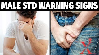 Common STDs Warning Signs amp Symptoms of Viral STDs [upl. by Dalury]