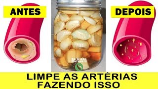 Esta Receita SUGA A GORDURA das Veias Igual Aspirador Suga Poeira [upl. by Waltner901]