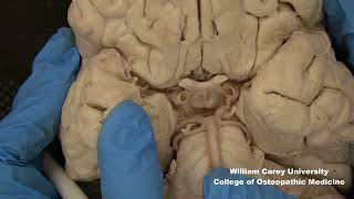 Ventral brainstemhypothalamus neuroanatomy hypothalamus brainstem anatomymedicalstudentbrain [upl. by Kahcztiy229]