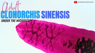 Adult Clonorchis sinensis under the microscope [upl. by Ailema]