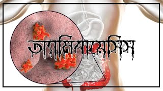 Amoebiasis I Entamoeba histolytica I Bengali Video I Bangla Video [upl. by Stormie]