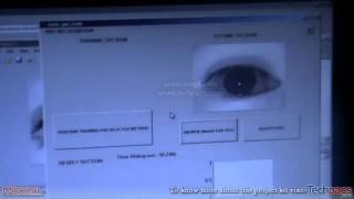 IRIS Based Secure Access  IRIS Scan System  Biomertic Identification using Arduino latest [upl. by Aseral]