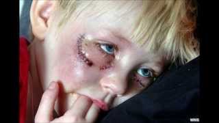 Child Abuse Documentary Film [upl. by Mandell]