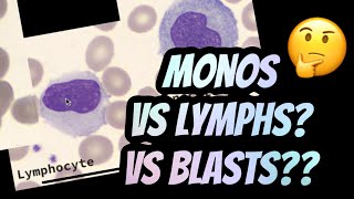 How I distinguish between Lymphocytes vs Monocytes [upl. by Oiliduab]