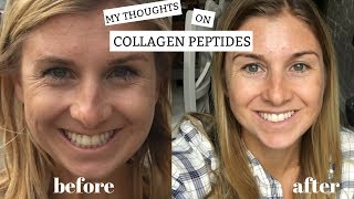 My Thoughts on Collagen Peptides  Benefits  Plus My Before and After [upl. by Naejarual]