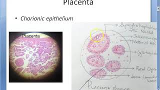 Obstetrics 243 GESTATIONAL TROPHOBLASTIC DISEASES Placental tumor Hydatidiform Mole Choriocarcinoma [upl. by Behre]