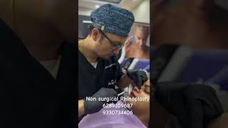 NON SURGICAL RHINOPLASTYdranirbanghoshvasergynecomastiarhinoplastybeforeandafternosejobs [upl. by Aserret]