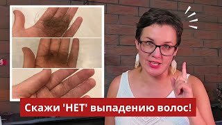 Как остановить выпадение волос натуральные методы которые работают [upl. by Gwen]