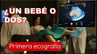 PRIMERA ECOGRAFÍA 6 SEMANAS EMBARAZO  Latido cardiaco ¿Un bebé o dos ¿GEMELOS [upl. by Ettedualc]