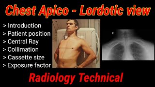 Chest Apico  Lordotic View XRay  Chest radiography   By BL Kumawat [upl. by Enaerb]