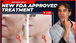 REMOVE JOWLS amp TIGHTEN YOUR FACE WITHOUT SURGERY Everything You Need To Know NEW Approved Procedure [upl. by Goodyear963]