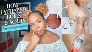 How I STOPPED HS Boils amp Scars in Armpits amp Thighs  TMI Hygiene Shower Routine Diet  MORE [upl. by Yornek]