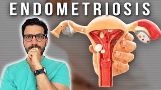 ENDOMETRIOSIS Causas síntomas y tratamiento DoctorMauInforma [upl. by Dric]