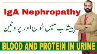 Blood and Protein in urine  【IgA Nephropathy in UrduHindi】 [upl. by Notxap]