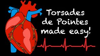 EMS Cardiology  Tachy Tuesday Torsades de Pointes [upl. by Josee]