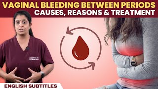 Vaginal Bleeding Between Periods  மாதவிடாய் இல்லாமல் ரத்தப்போக்கு ஏற்பட என்ன காரணம் [upl. by Eirrahs229]