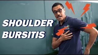 Shoulder Bursitis [upl. by Nuris568]