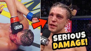 Brian Ortega takes SERIOUS DAMAGE  Doctor Explains Injury Concerns from UFC 266 Fight of the Year [upl. by Ardnaskela]