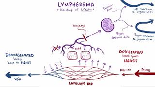 Lymphedema causes symptoms diagnosis treatment amp pathology [upl. by Mobley]