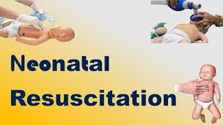 Neonatal Resuscitation  TOACS amp OSCE Station [upl. by Divadnoj]