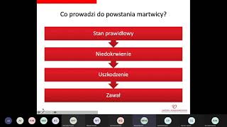 Warsztaty EKG kurs podstawowy 4 Manifestacje niedokrwienia i martwicy [upl. by Rramo853]