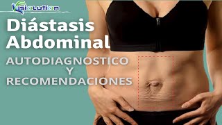 DIÁSTASIS ABDOMINAL  AUTODIAGNÓSTICO y RECOMENDACIONES  Fisiolution [upl. by Assin]