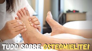 OSTEOMIELITE  O QUE É SINTOMAS E TRATAMENTO [upl. by Dnalyram]