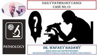 DAILY PATHOLOGY CASES CASE NO 10 Dr Wafaey Badawy [upl. by George72]