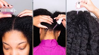 Apply Red Onion Juice On Your Scalp To Increase Thickness and Volume Of Hair [upl. by Nessah595]