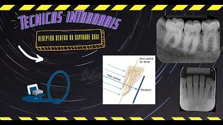 Técnicas radiográficas Intraorais Periapical Interproximal Oclusal [upl. by Pollard]