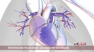 Ipertensione polmonare un video per informare [upl. by Ahseiym231]