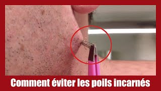 Comment éviter les poils incarnés [upl. by Atisor]