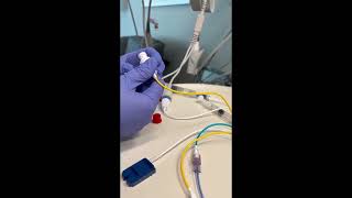 Connecting your SwanGanz catheter to the Hemosphere [upl. by Boehmer]