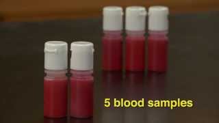 Blood Typing Exercise [upl. by Crispen]