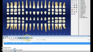 Dentrix step by step  Charting [upl. by Munafo535]