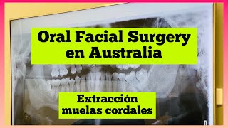 Cuánto cuesta la cirugia para extraer muelas del juicio o coredales en Australia Shorts [upl. by Notlrac344]