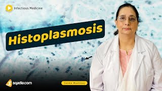 Histoplasmosis  Infectious Diseases Medicine Lecture  Medical School Student  VLearning [upl. by Norvol]