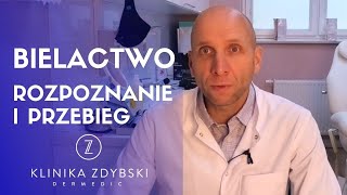 Dermatolog mówi o Bielactwo  rozpoznanie i przebieg [upl. by Perpetua234]