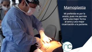 Mamoplastia  Dr Nelson Chaves [upl. by Aivartal]