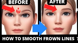 HOW TO GET RID OF WRINKLES BETWEEN THE EYEBROWS WITH FACE YOGA  NATURALLY  EASY STEP [upl. by Jolanta]